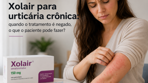 Xolair para urticária crônica: quando o tratamento é negado, o que o paciente pode fazer?