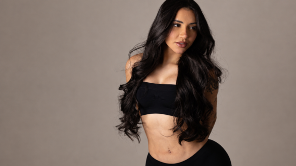 Tainá Costa fala pela primeira vez sobre cirurgia com o Dr. José Cury